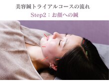 シー バイ カリスタ 池袋店(C by CALISTA)/美容鍼トライアルコースの流れ