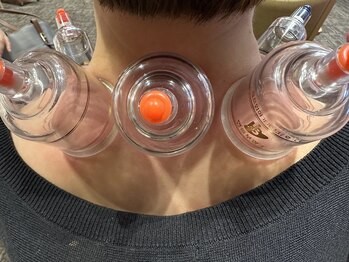 グリーン(green)/肩カッピング♪