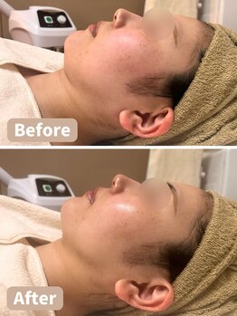 リオ(RIO)/顎下にご注目！　