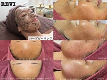 ベルティーク(beltheQue)