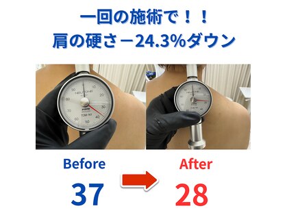 ココリラの写真