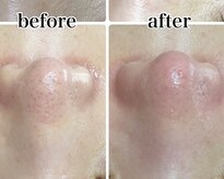 ラウレア(Laule'a)