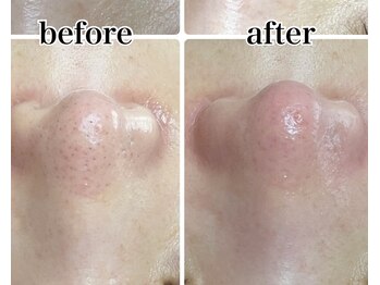 ラウレア(Laule'a)