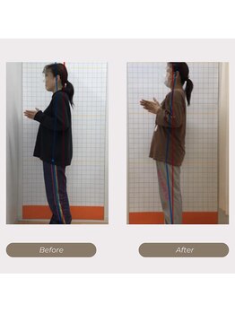 かがわ接骨院 高松伏石院/姿勢の悪さでお悩みの方！