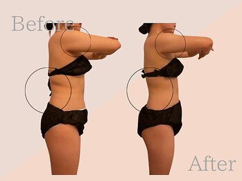 ファミーユ 名古屋店/【ブライダル】痩身、ダイエット