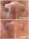 ラウレア(Laule'A)の写真/【結果重視◎】毛穴専門店出身のベテランスタッフによるオーダーメイド施術で、毛穴レスな水光美肌へ☆