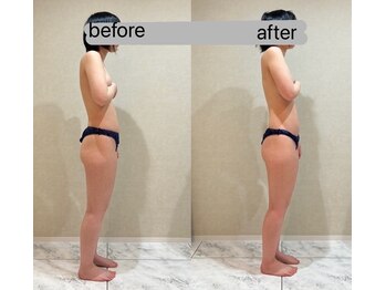 シェリーナ(cherieNa)/美骨ボディ【スウェイバック】