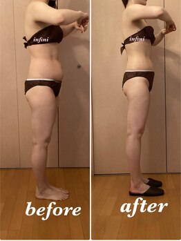 アンフィニ(infini)/ブライダル短期集中9回目4ヶ月