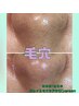 【毛穴全顔取り放題☆】話題の毛穴エクストラクションtete式　¥11000