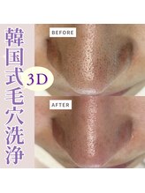 モーヴ(MAUVE)/韓国式３D毛穴洗浄