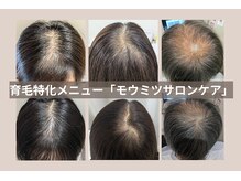 スカルプラボ(Scalp Lab)
