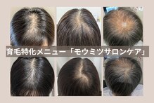 スカルプラボ(Scalp Lab)
