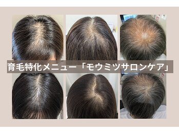 スカルプラボ(Scalp Lab)