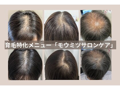 スカルプラボ(Scalp Lab)の写真