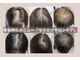 スカルプラボ(Scalp Lab)の写真
