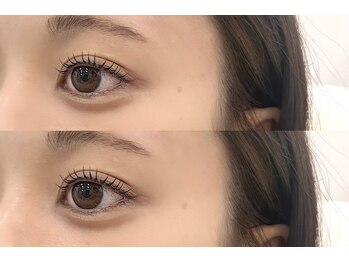 アルーマ アイ(allma.eye)/まつ毛パーマ/ラッシュリフト