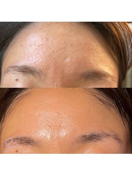 ジュエッテ(jouete)/シーナジーピール