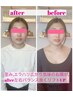 【美容療法に頼らず別人級小顔】エラハリ,歪み,むくみ整え頭蓋骨小顔矯正70分