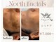 ノースフェイシャルズ(North facials)の写真
