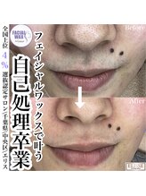 エリス(ELISSE)/自己処理は絶対だめ！