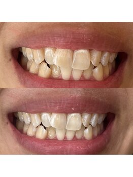 シエル 美里店(ciel)/セルフホワイトニング