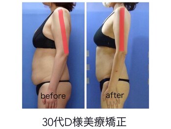 エステージ(estage)/