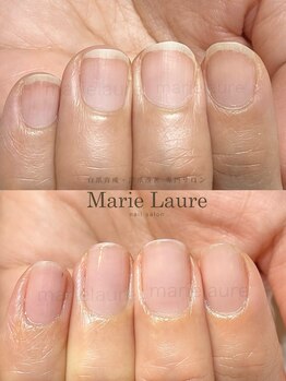 マリーロール 天王寺店(Marie Laure)/自爪育成/深爪矯正/ネイルケア