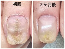 ネイルサロンエマ(EMA)の雰囲気（デコボコに生えてくる爪も自爪育成で綺麗に♪）