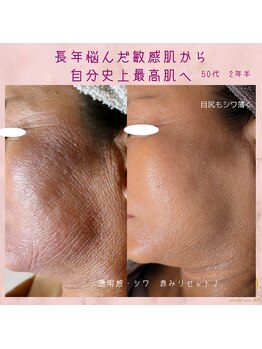 プライベートサロン 美月/