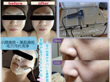 スノードロップ(snowdrop)の雰囲気（〇〇に特化は古い！美白/毛穴洗浄/小顔/全てGETのフェイシャル☆）