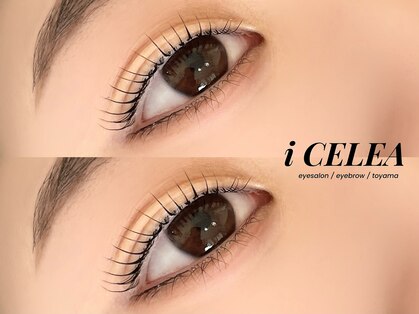 アイセレア(i CELEA)の写真