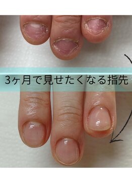 ココ ネイル サロン アンドスクール(COCO.NAIL SALON＆SCHOOL)の写真/爪が伸びない・噛んでしまう方へ
【3ヶ月で変わる爪育成サロン】
爪噛み改善/短い爪でも綺麗に見せる