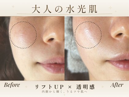 サロンアズ(salon AZU)の写真