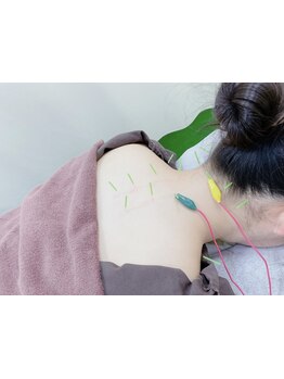 鍼灸施術を受けたい