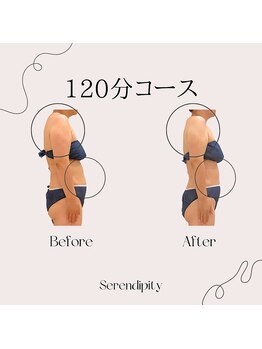 セレンディピティー(Serendipity)/猫背改善で見た目痩せ！