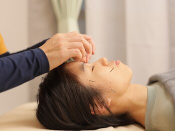 鍼灸院アゼ(AZE)/眼精疲労