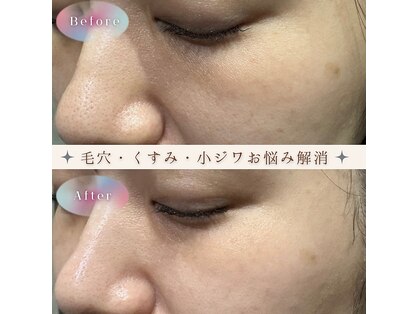 オンフリーク(ON FLEEK)の写真