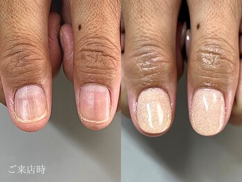 爪悩み専門店/