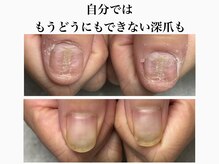 トレフル(Trefle)の雰囲気（他サロンで断られた深爪も、自分ではどうにもできない深爪も）