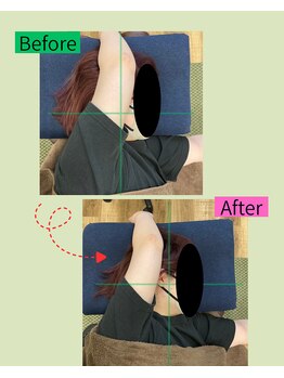 楽する鍼灸 整骨院 南福岡院/