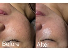 ディアーム 岸和田カンカン店(Diarm)/レッドショット