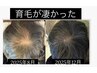 【初回体験】育毛促進コース　30分　通常11000円→4400円