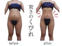 プレリー 自由が丘店/ラジオ派/筋膜リリース