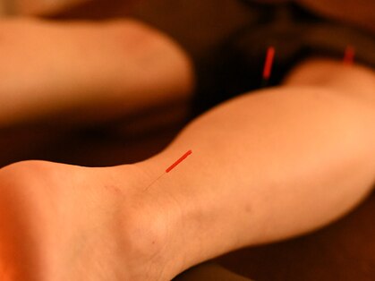 ハリ是好日の写真