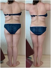 リノ(Lino)/全身スッキリ！ビフォーアフター