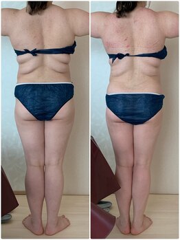 リノ(Lino)/全身スッキリ！ビフォーアフター