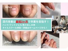 レジューネイル(Rejyu Nail)