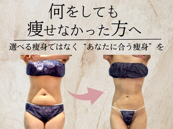 エクストリミティ 国立店(EXTREMITY)/体質に合わせた痩身