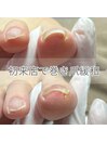 ご来店当日から巻き爪が緩和