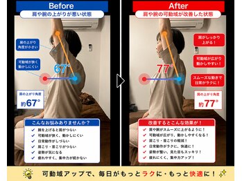笑う門 新小岩店/腕が上がりやすく